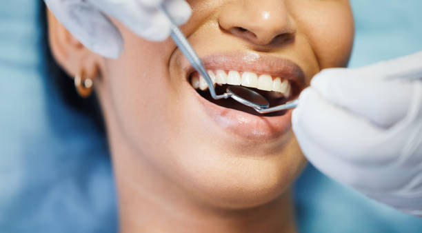 Best Emergency Broken Tooth Repair in Buchanan, GA